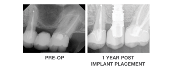 OraGen Case Study Images_Landing Page_01