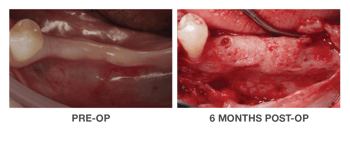 OraGen Case Study Images_Landing Page_02