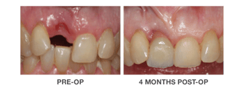 OraGen Case Study Images_Landing Page_03